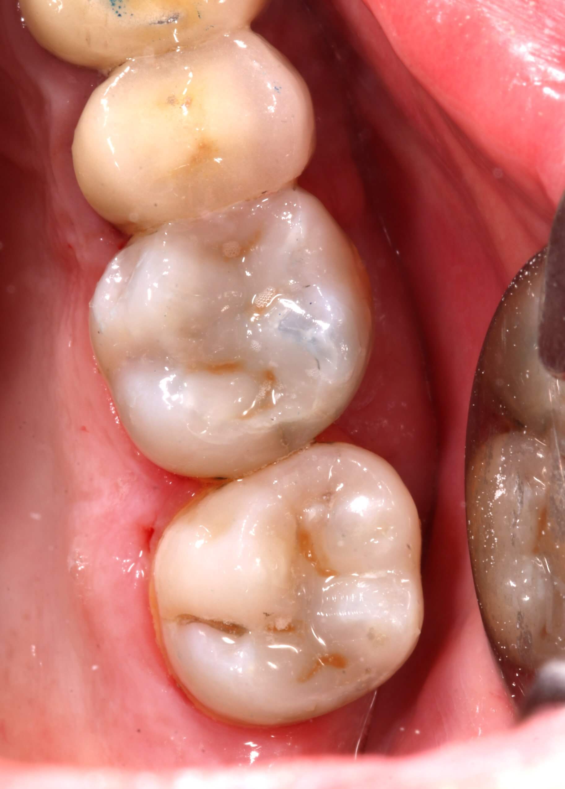 illustration bloc opératoire dentiste