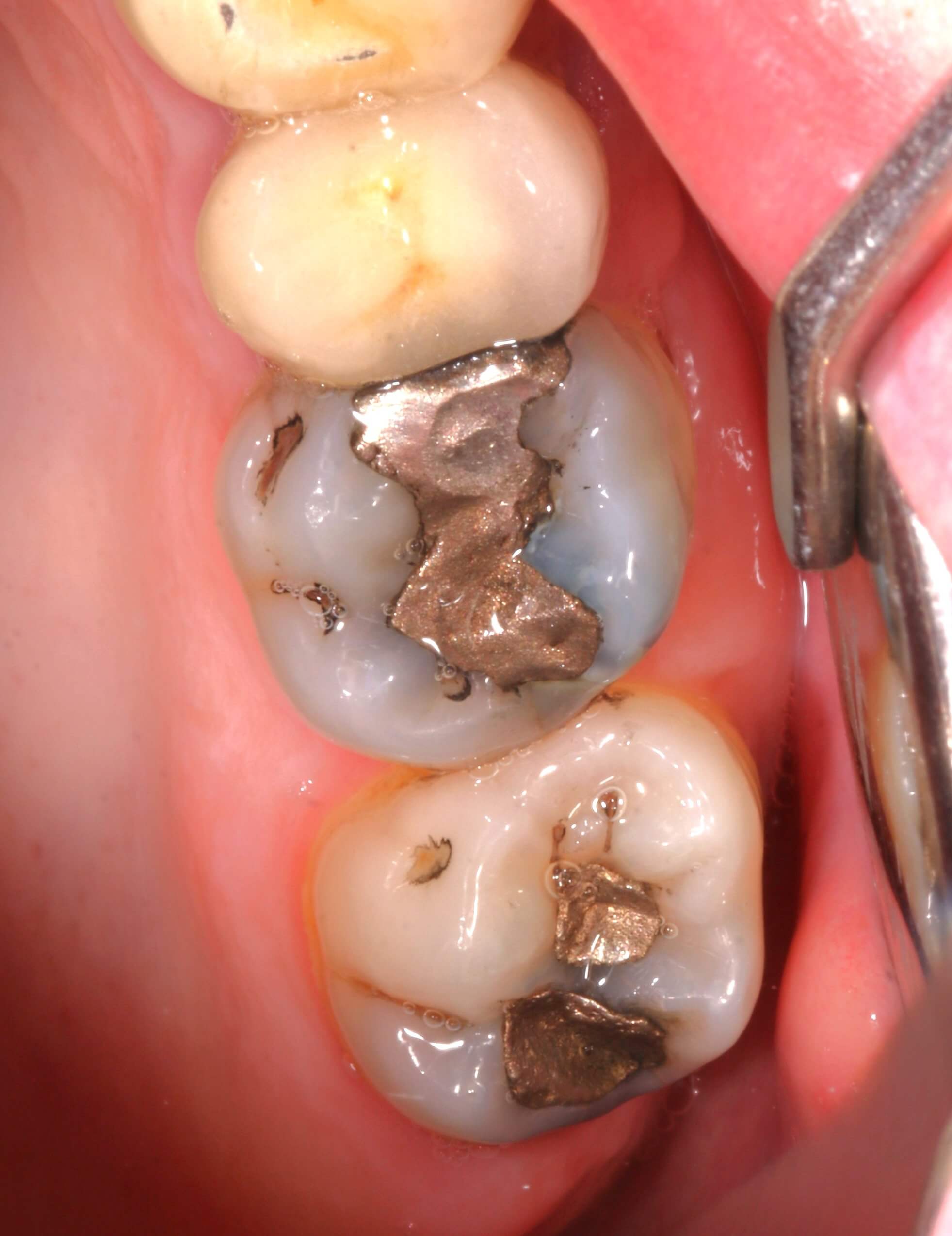 illustration bloc opératoire dentiste