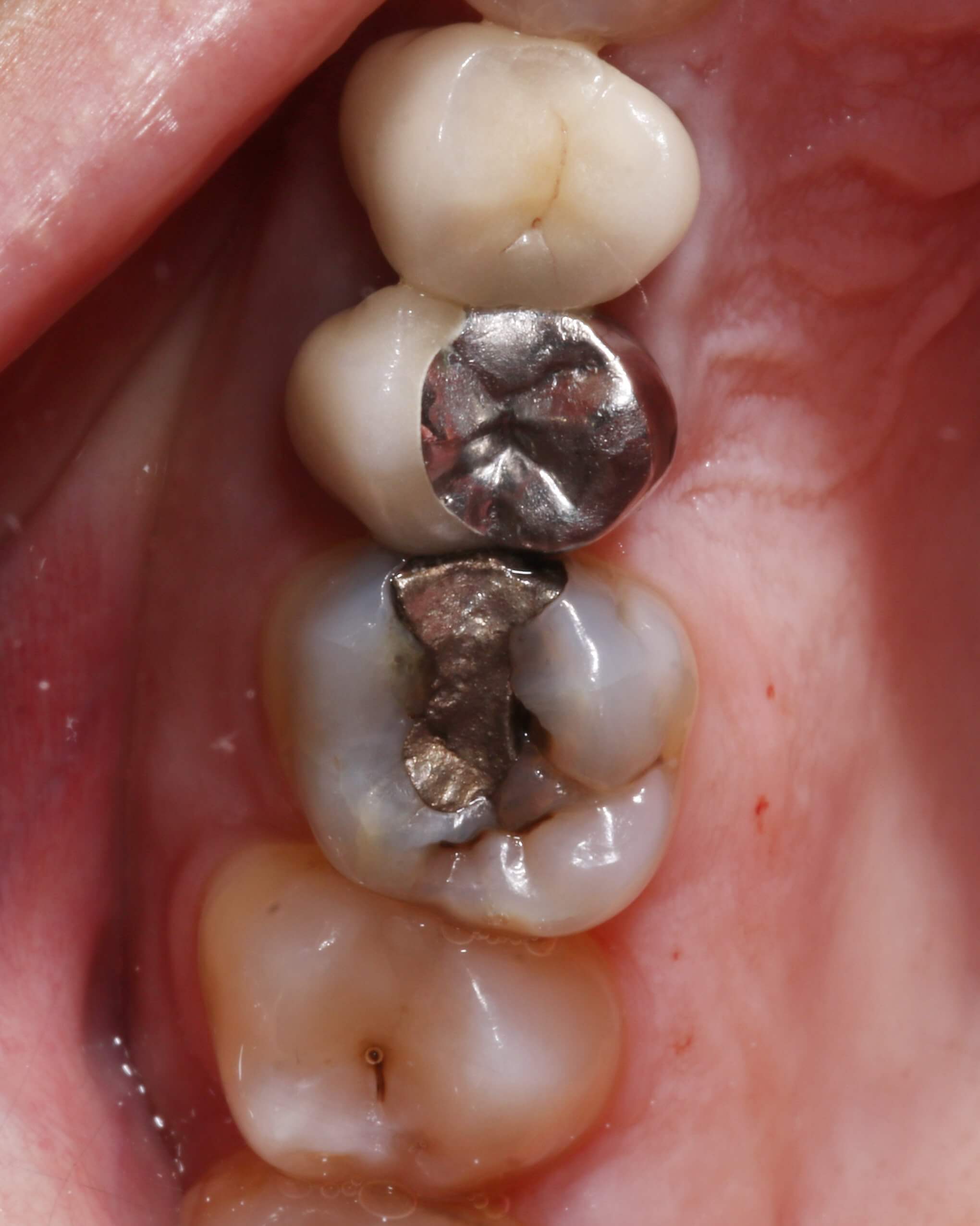 illustration bloc opératoire dentiste