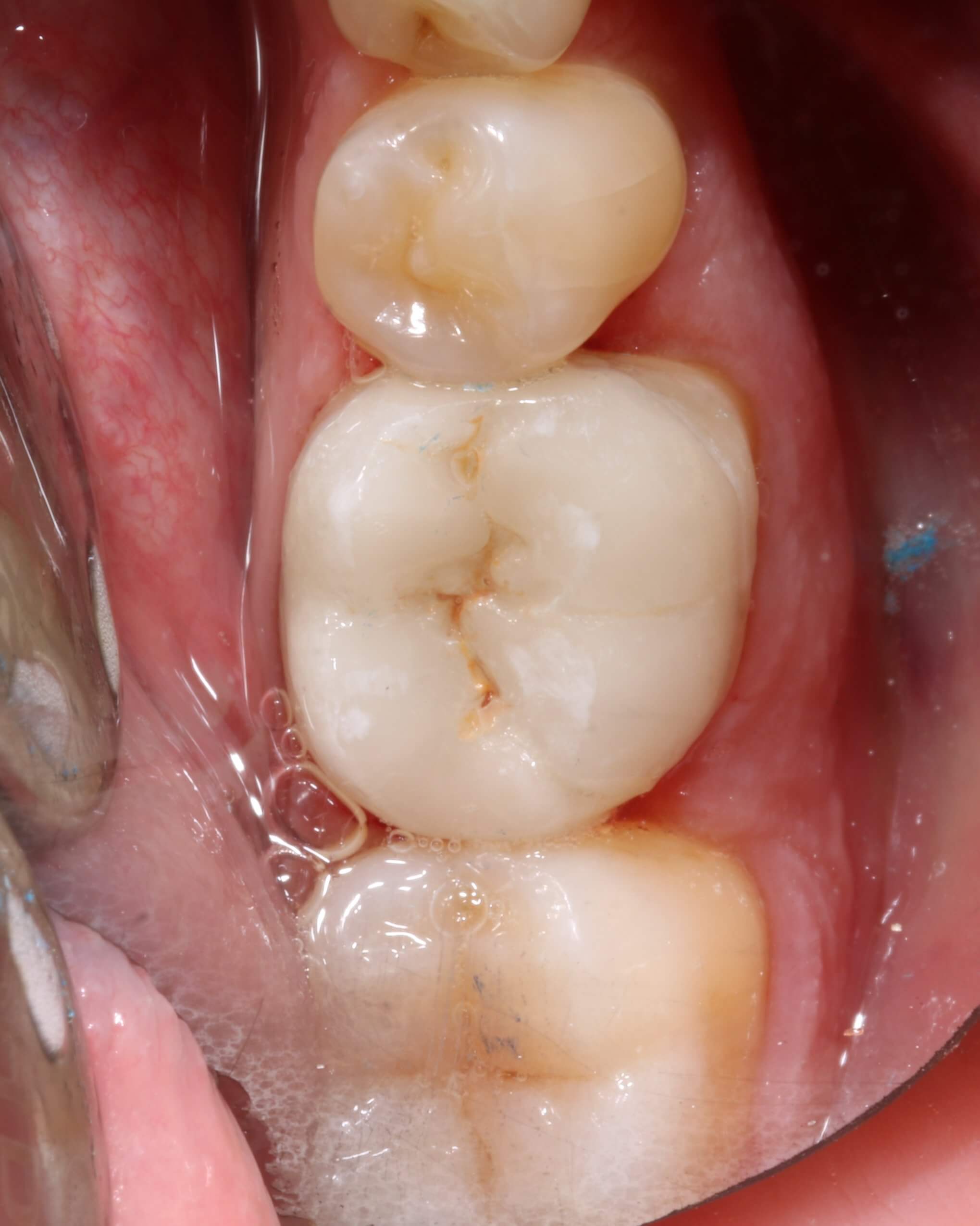 illustration bloc opératoire dentiste