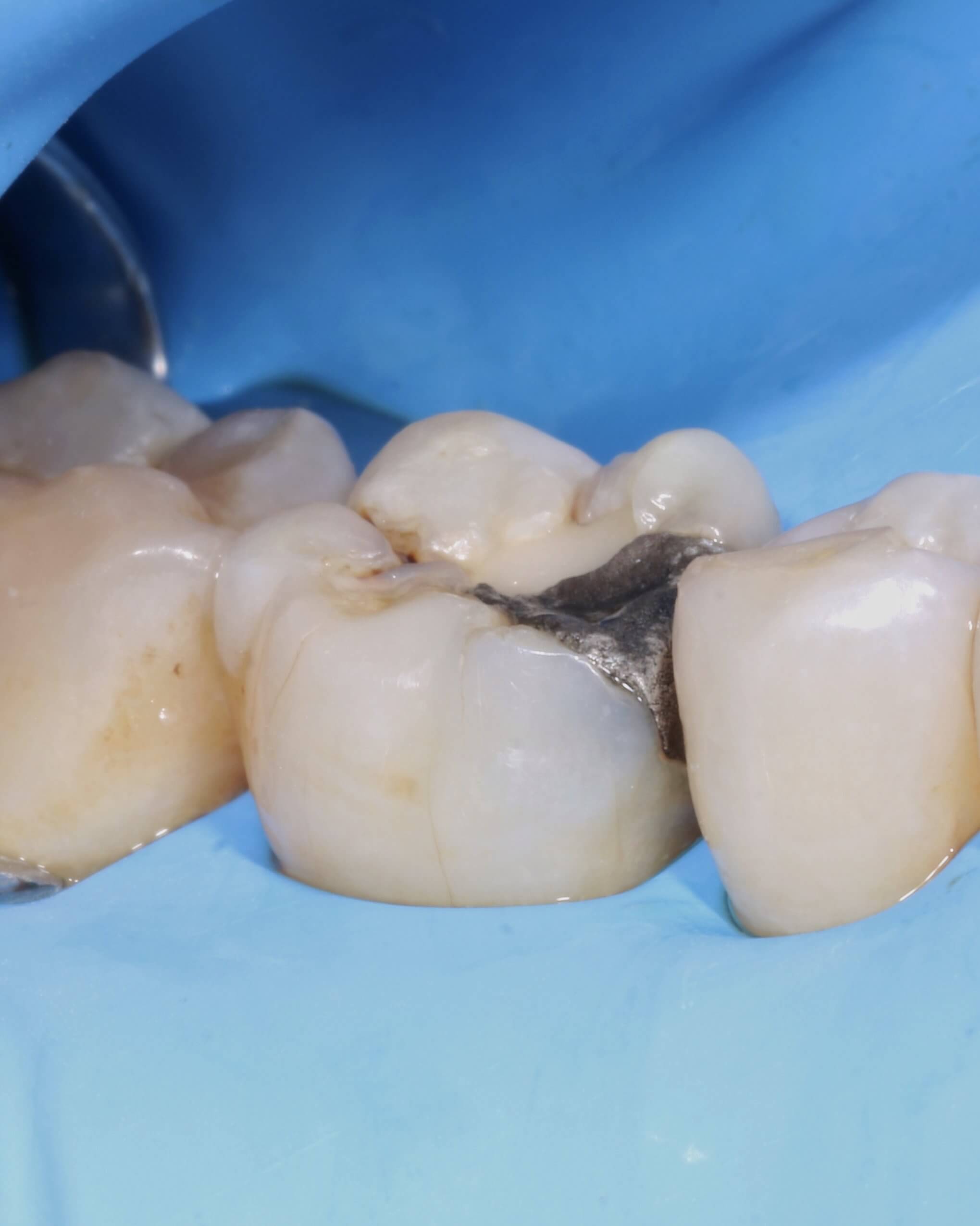 illustration bloc opératoire dentiste